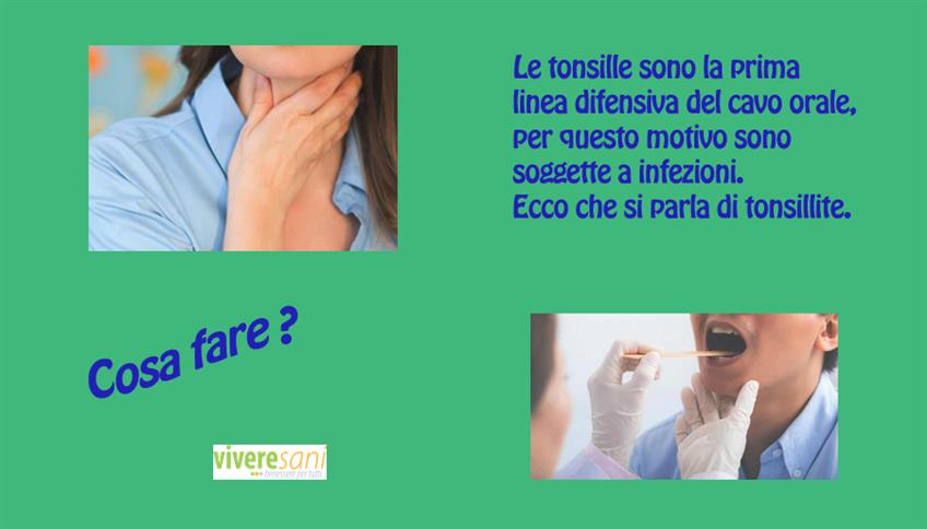 Se le tonsille spesso vanno in fiamme Se le tonsille spesso vanno in fiamme